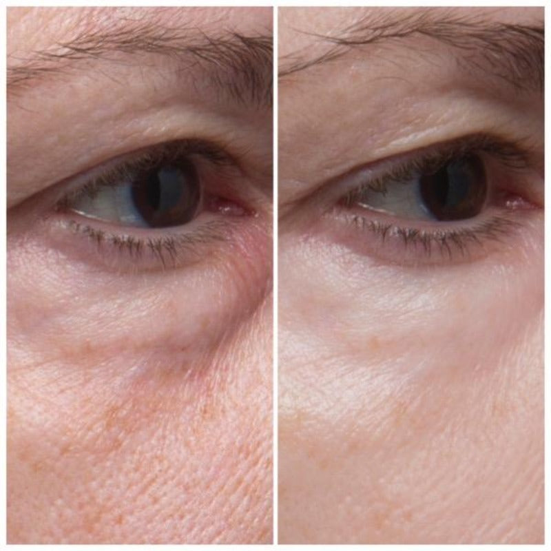 FRANZ Botalin Age Repair Eye Serum